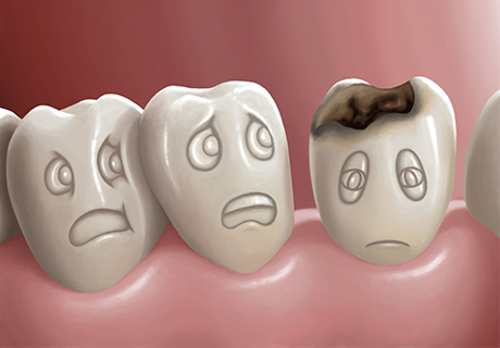 虫歯は早期発見・早期治療が大切です～一般歯科～