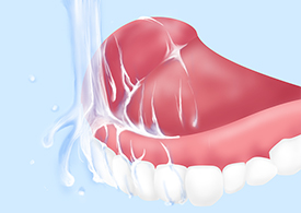 入れ歯のお手入れの注意点
